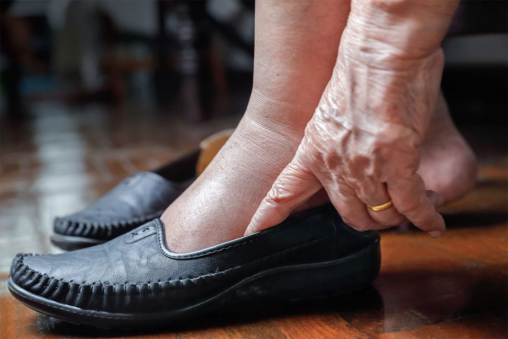Zapato pie diabetico